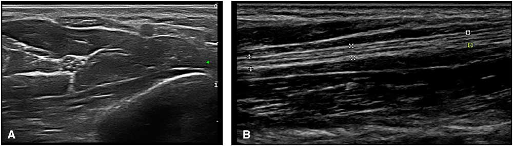 Neuromusculoskeletal